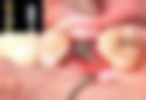 五、深圳赛德阳光美添口腔门诊舒适就医环境，打造人性化诊疗体验