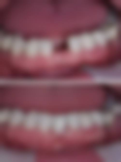 七、上海雅科特口腔就医指南，便捷就诊不迷路