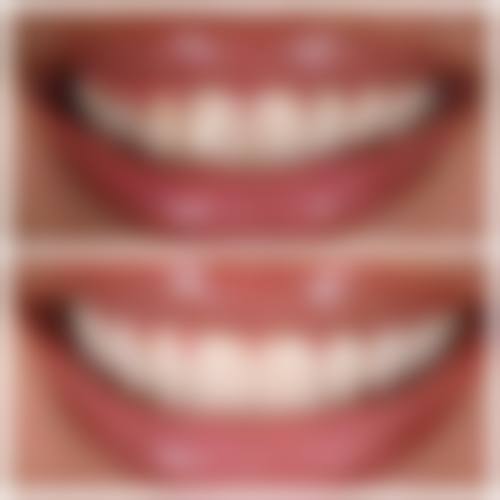 二、南京优恩齿科门诊部医生团队，打造专精诊疗服务