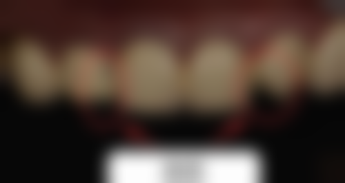 五、广东惠州德瑞馨口腔舒适就医环境，打造人性化诊疗体验