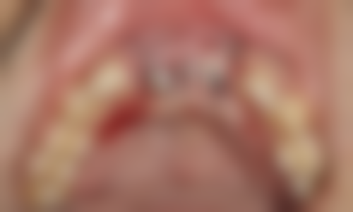 七、北京佳美口腔通州新光门诊就医指南，便捷就诊不迷路