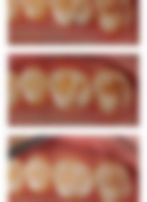 四、广东惠州德瑞馨口腔设备介绍