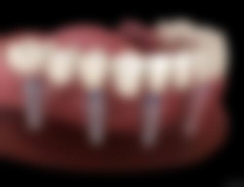 四、济南妤霄口腔诊所设备介绍