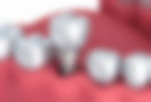 七、苏州高新丽齿口腔诊所就医指南，便捷就诊不迷路