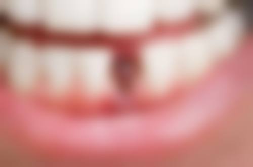 七、德州洁雅口腔门诊部就医指南，便捷就诊不迷路