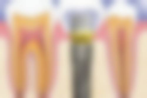 希瑞口腔诊所的技术优势与医生团队:严谨、微创、个性化