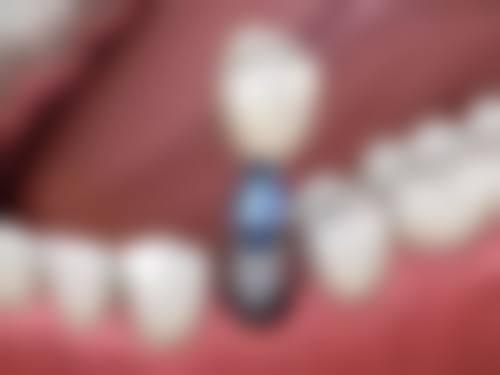 四、日照凯思口腔医院设备介绍