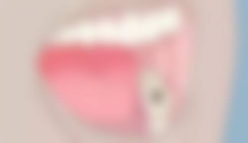 患者口碑见证:在希瑞口腔诊所看牙是一种怎样的体验?