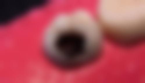 希瑞口腔诊所正规吗?从细节看一家诊所的底线与职责