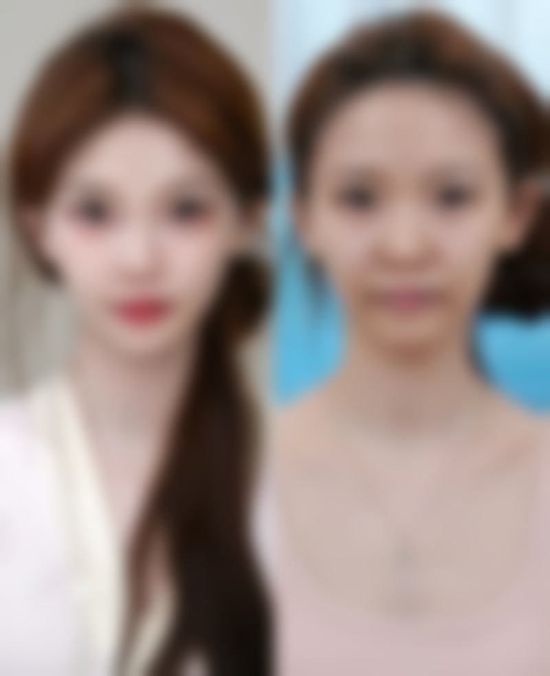 快问快答:眉山蝶儿医学美容诊所热门问题解答
