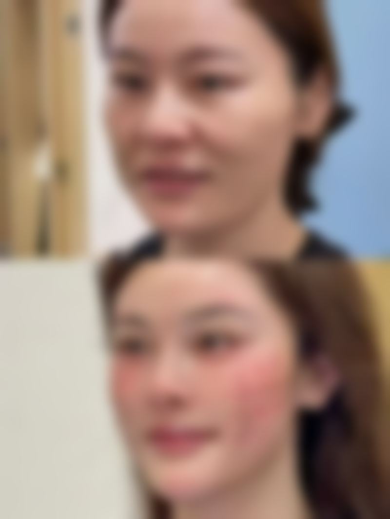 眉山蝶儿医学美容诊所口碑好评:听听求美者怎么说