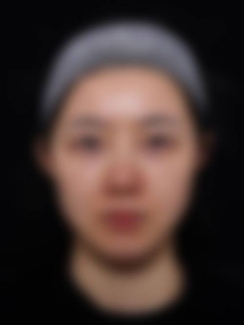 关于济宁韩骏医疗整形美容医院，这些高频问答收好