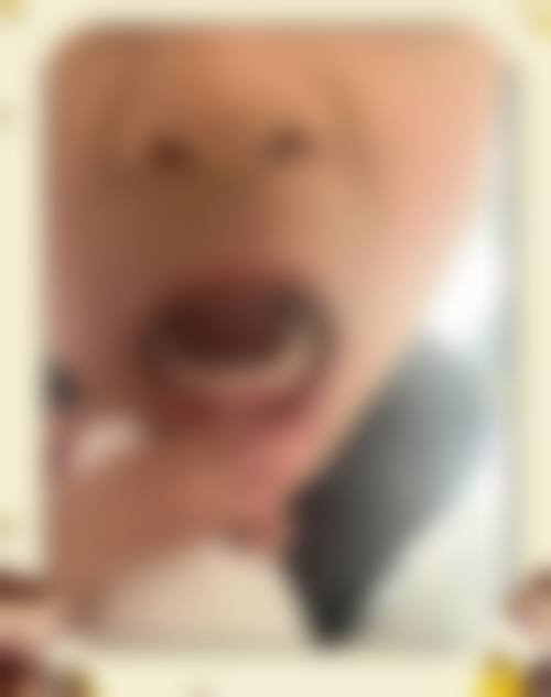黄石春天口腔门诊部看牙收费贵吗?收费标准一览