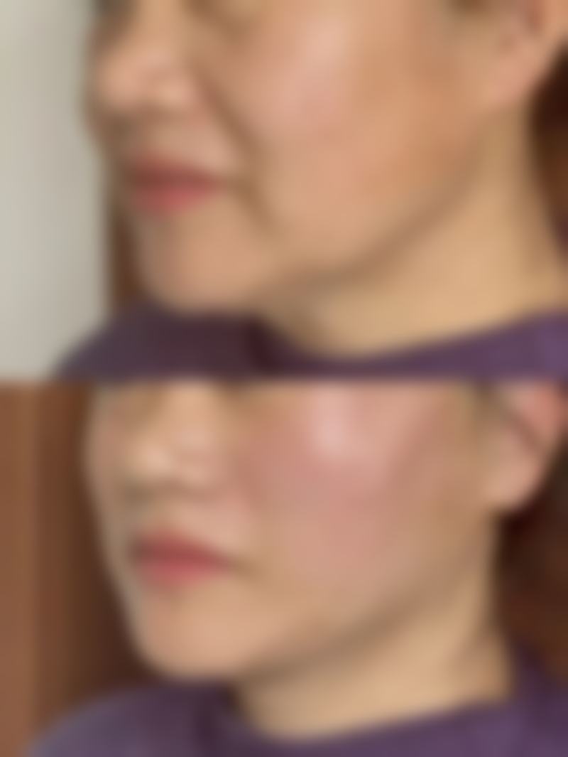 关于秦皇岛巧致整形医院张凯华医生,你想知道的快问快答