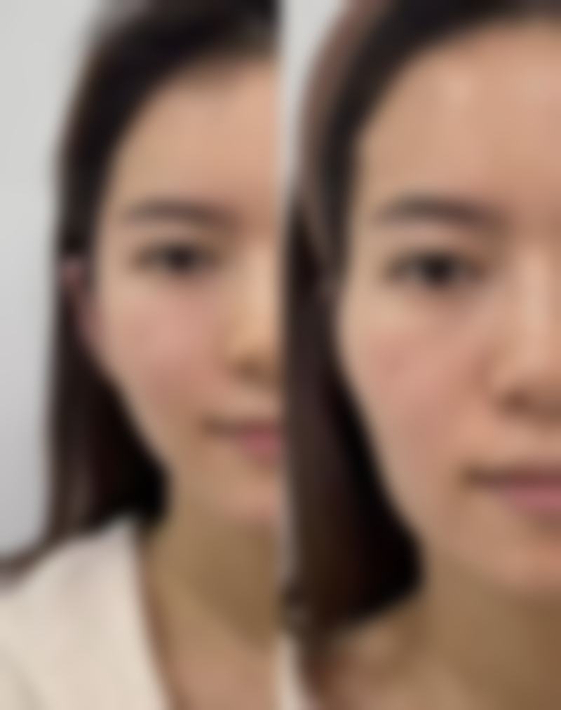 任加伟医生擅长哪些整形项目?如何选择?
