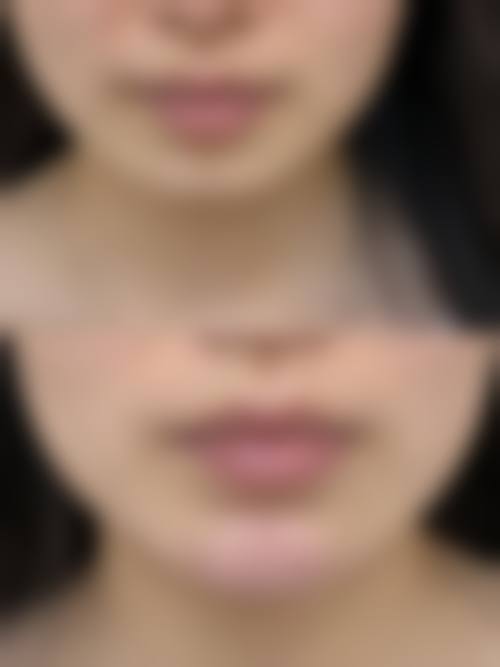 上海美奂纽添医疗美容诊所的收费标准:2026年热门项目价格参考