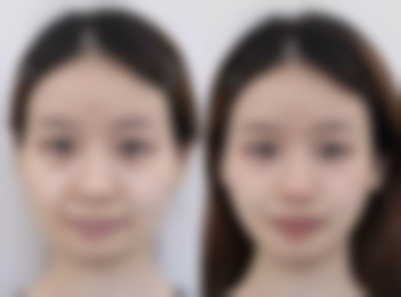眉山蝶儿医学美容诊所胡霞医生怎么预约挂号？