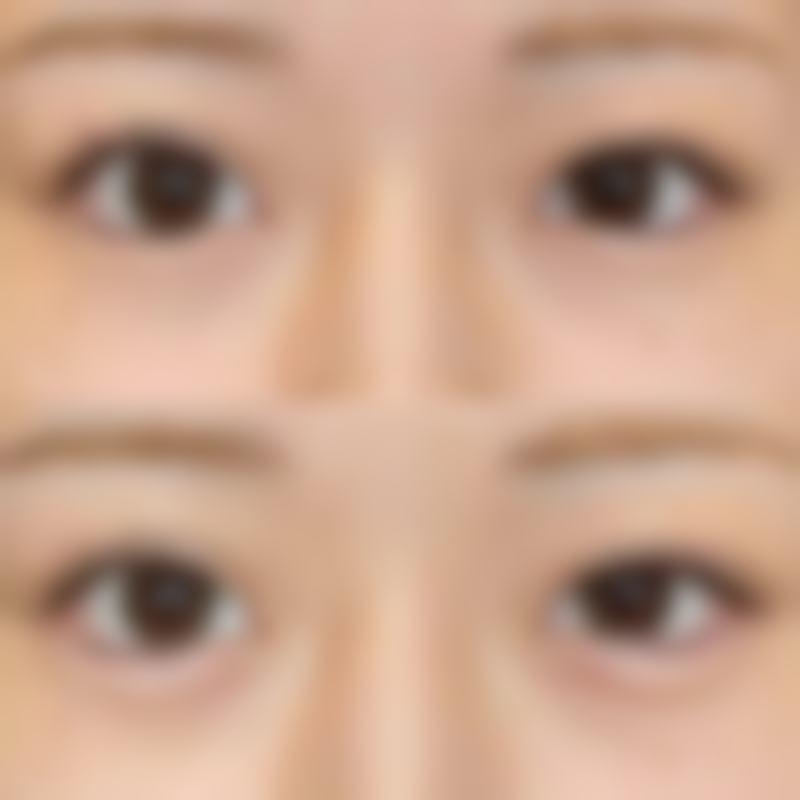 上饶信州饶美医疗美容门诊部收费价格表（2026年参考）