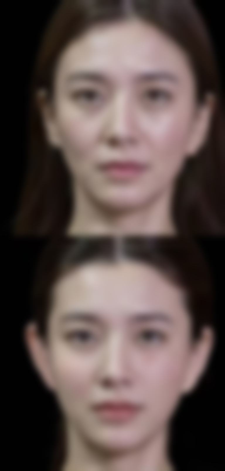 眉山蝶儿医学美容诊所胡霞医生擅长项目有哪些？