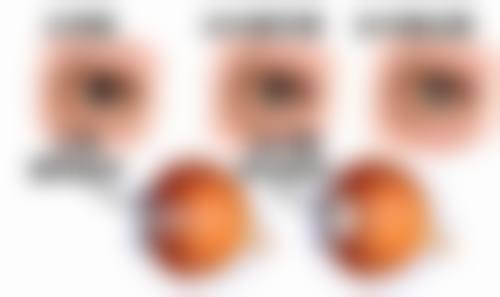 昆明医 科 大学第一附属医院眼科擅长哪些项目？特色优势是什么？