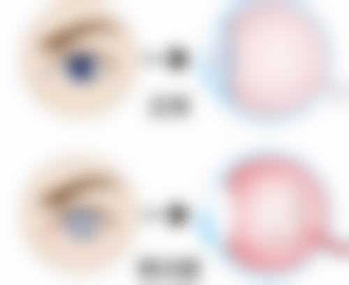 昆明医 科 大学第一附属医院眼科患者口碑好不好？有哪些好评？