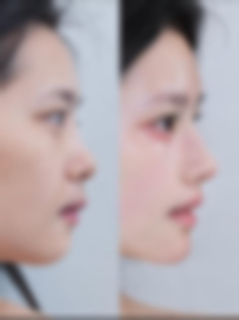 成都羽妃医疗美容门诊部有哪些优势项目?技术特色全解析