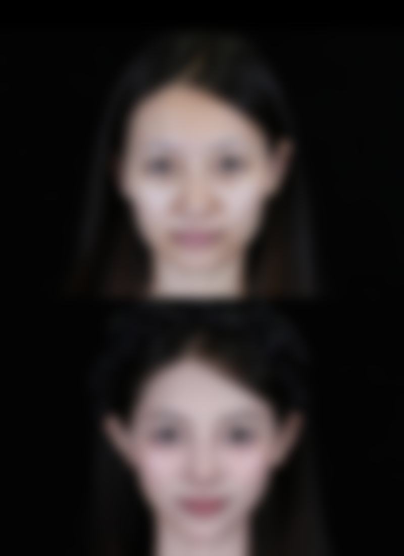 技术好、审美在线,袁磊医生为美丽“保驾护航”