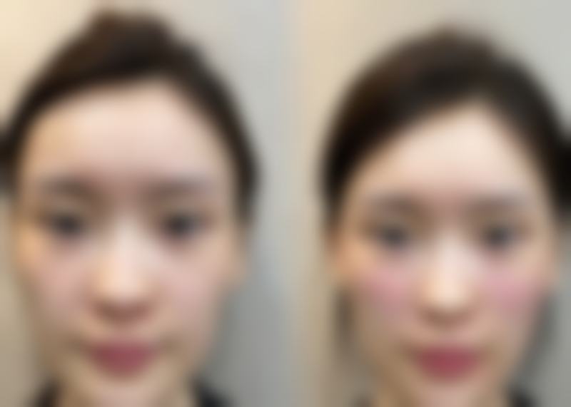 邯郸市第三医院医学美容科怎么预约挂号?地址在哪?