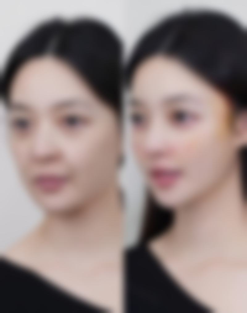 成都羽妃医疗美容门诊部医生团队如何?王陈玄医生技术亮点