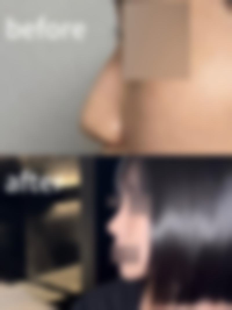 快问快答:关于鞍山润美整形医院的常见疑问解答