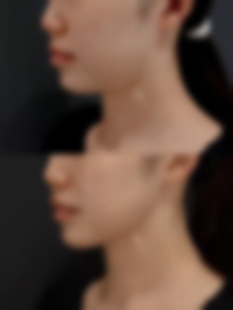 怎么预约南昌星璨医疗美容门诊部?面诊流程快问快答