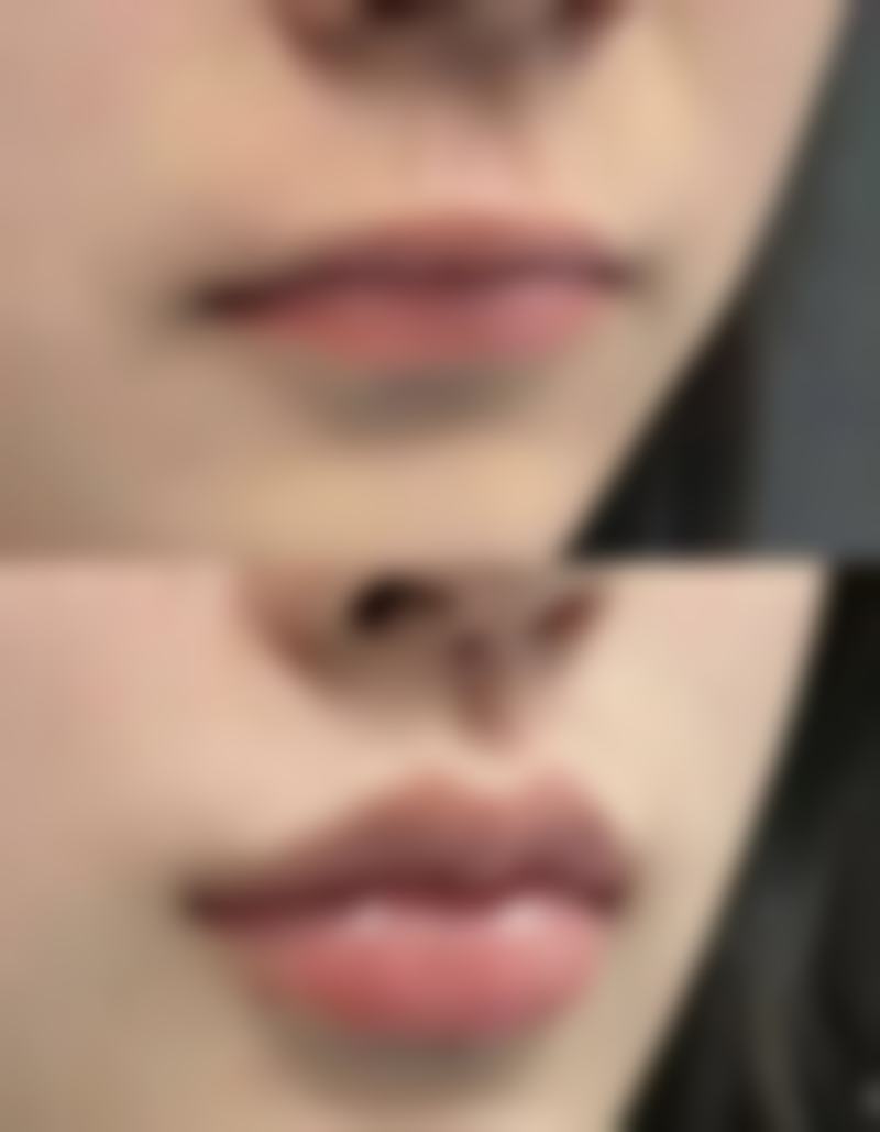 求美者如何评价?来看看鞍山润美整形医院的真实口碑