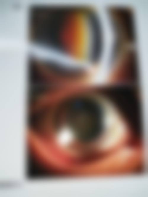 红安爱尔眼科医院擅长项目：哪些诊疗方向更有优势？