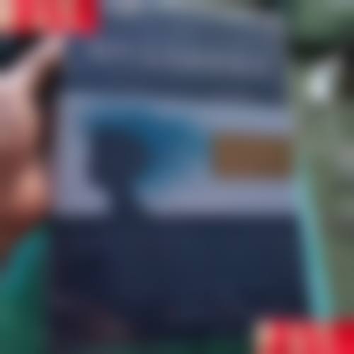 张卫国医生的口碑好不好?找他做植发有什么真实反馈?