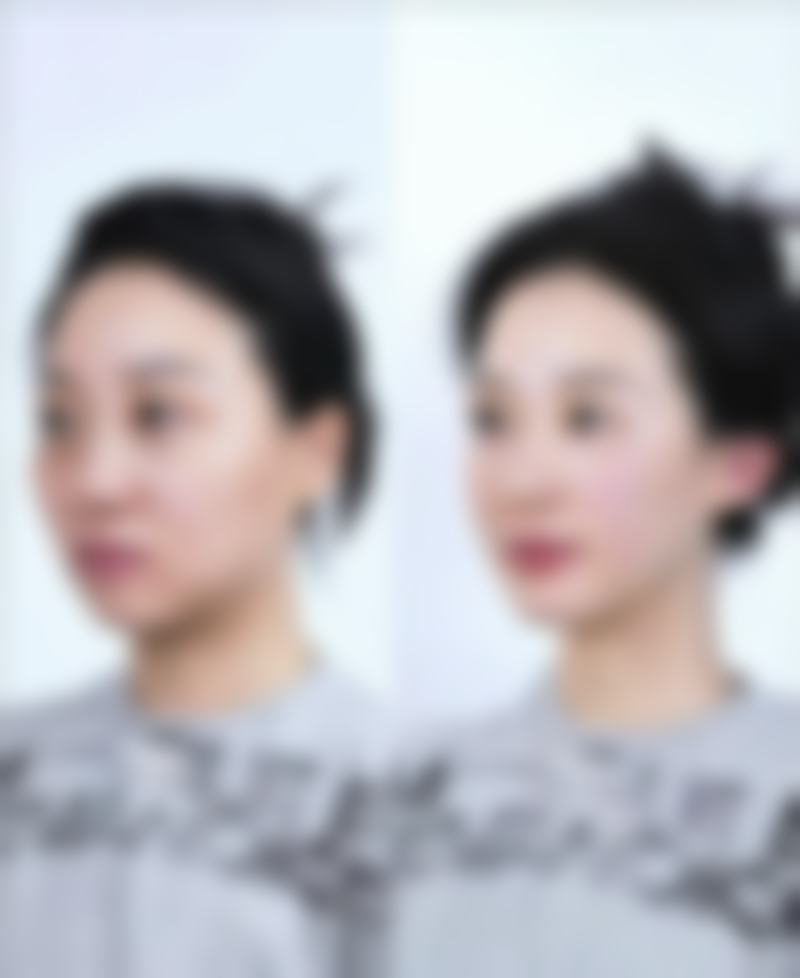成都羽妃医疗美容门诊部王陈玄医生收费价格表(2026年)