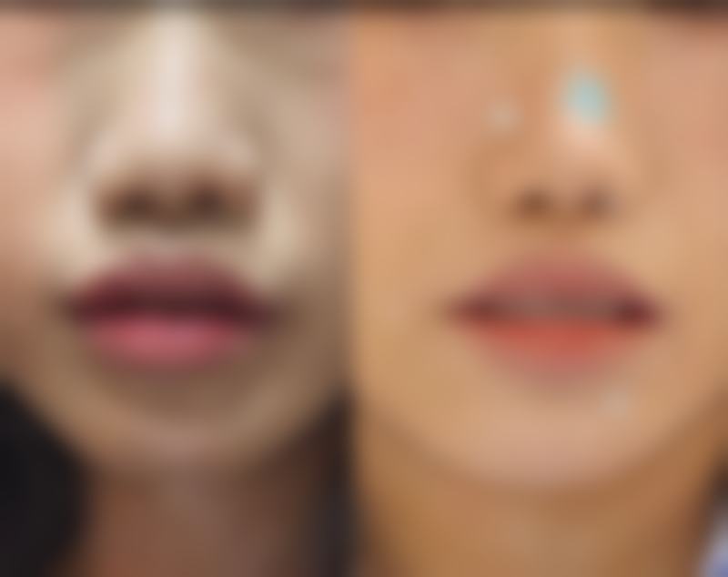 预约挂号与前往路线,轻松开启美丽之旅