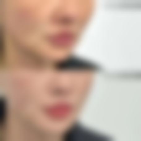 杨穗医疗整形美容机构的王牌项目:技术为核,审美为魂