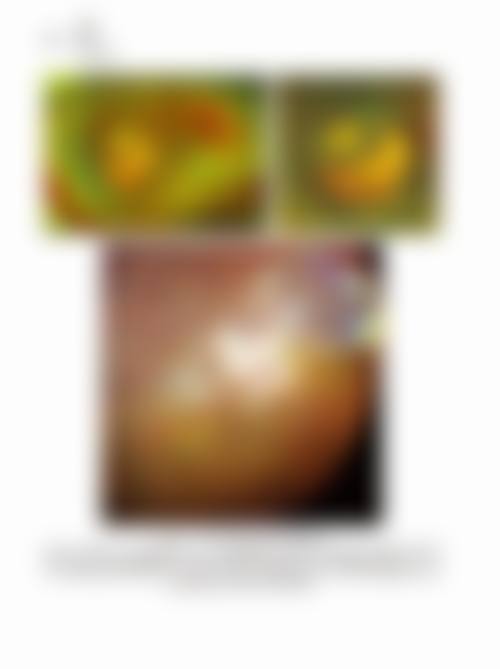 如何预约昆明医 科 大学第一附属医院眼科罗廷浩医生的号？