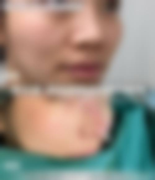 关于广东清远华康医院整形美容科的常见疑问解答