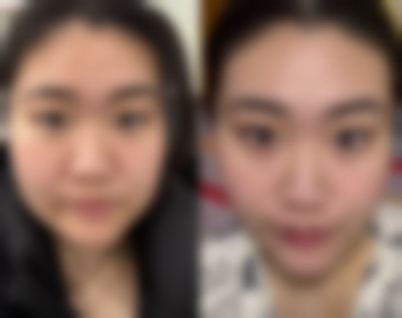 合肥包河福华世家医疗美容门诊部擅长什么?从吸脂到眼鼻综合的精细化操作