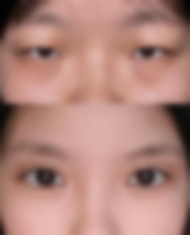淮安俏美医疗美容门诊部李伟贤医生的收费价格贵吗?2026年价格参考