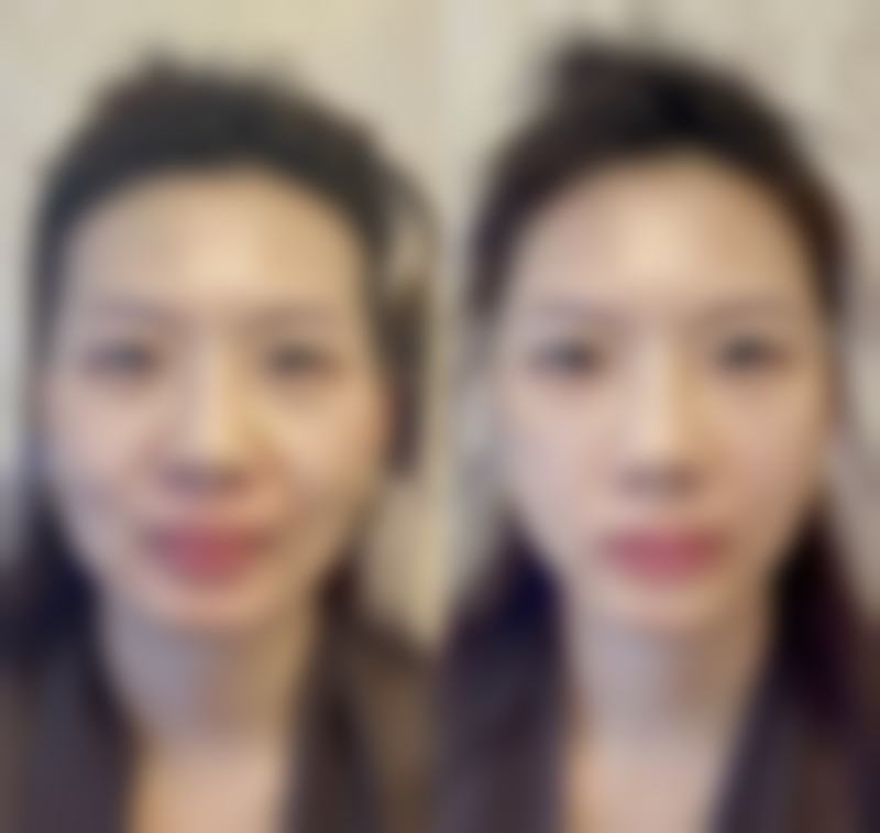 在淮安俏美找李伟贤医生,擅长做哪些项目?