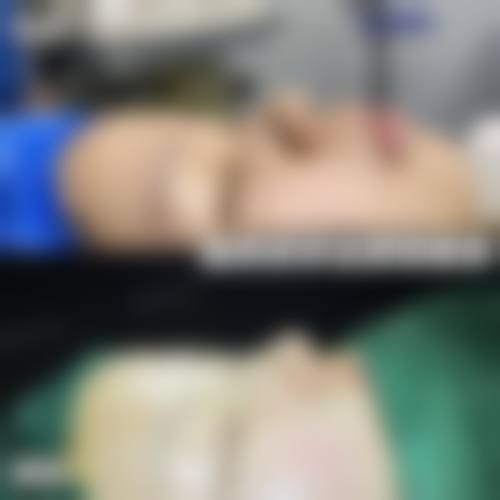 如何在秦皇岛巧致整形医院预约王立英医生?挂号就诊流程