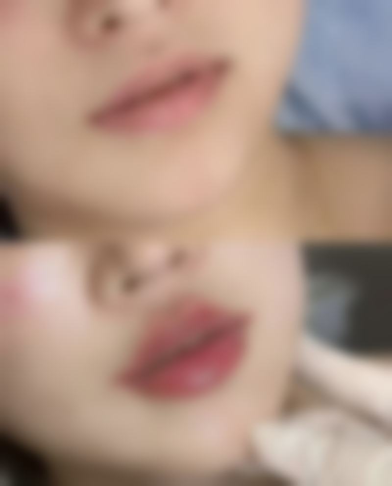 JP整形外科口碑好评:求美者眼中的真实体验