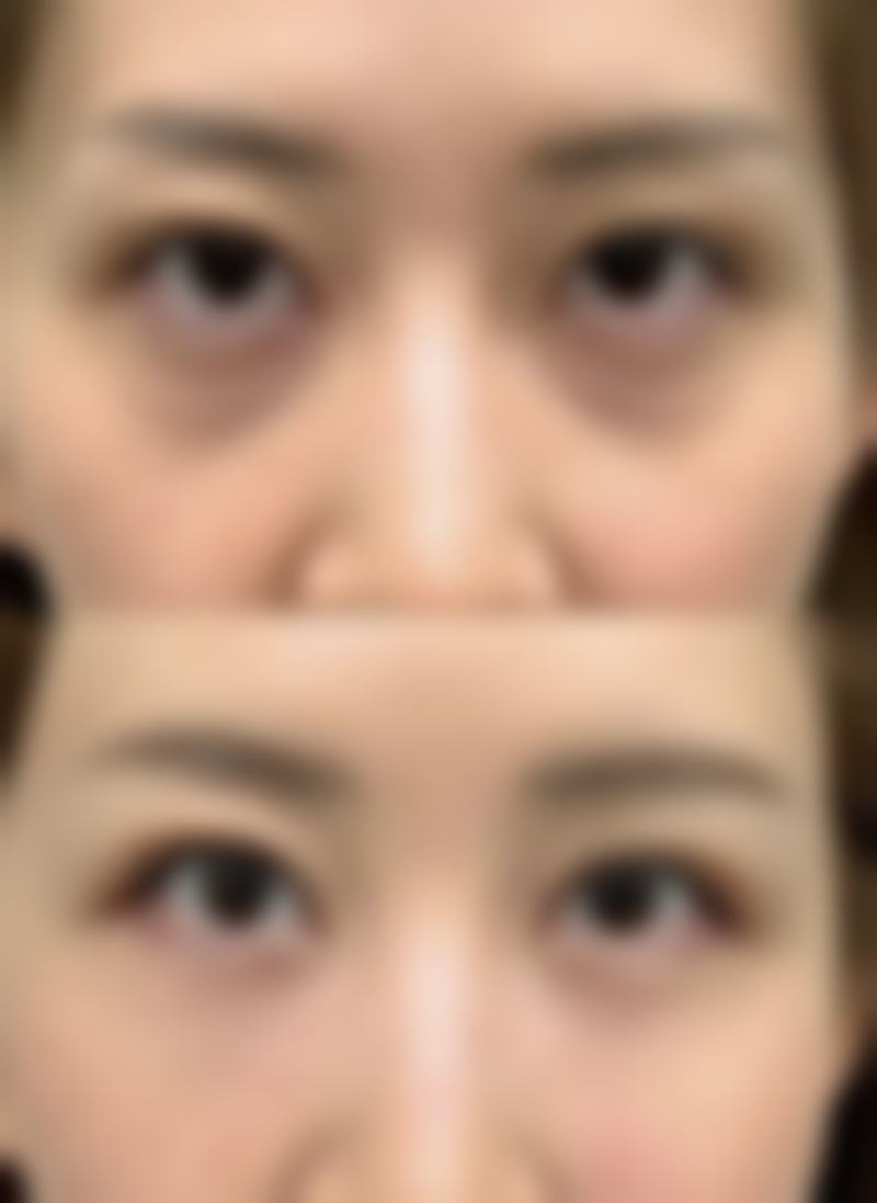 湘西臻美医疗美容门诊部擅长项目有哪些?如何选择是关键