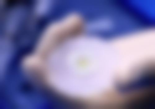 北京首瑞植发擅长做什么?从发际线到头顶全覆盖