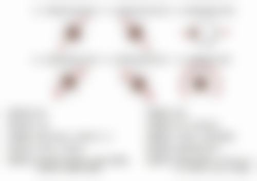 在北京首瑞植发做过的人是怎么评价的?