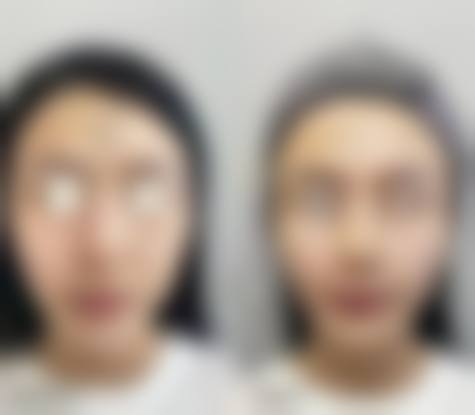 成都青羊吉曼整形医院怎么预约挂号？便捷通道指南