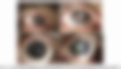 临汾市人民医院眼科快问快答:你想知道的都在这里