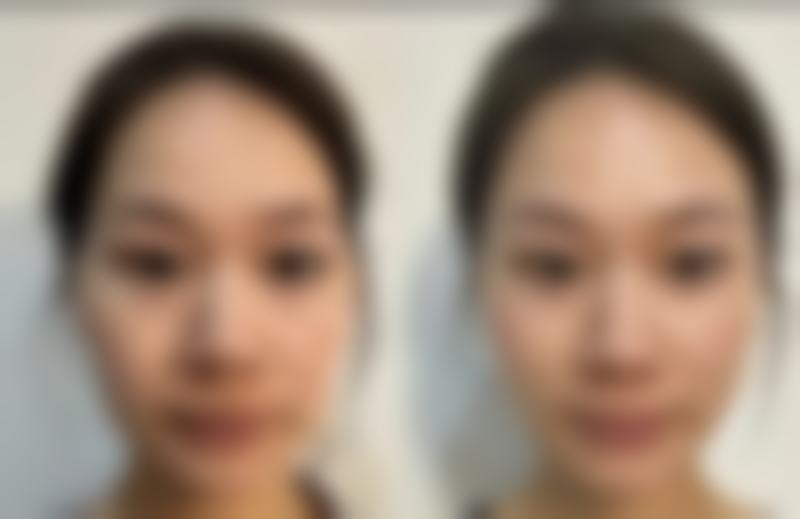 南京春语医疗美容诊所的特色项目,有哪些值得关注?